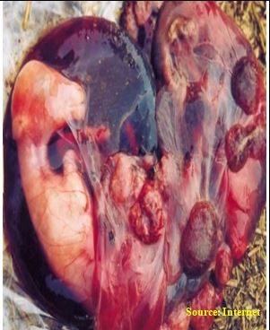Hemorrhagic placenta