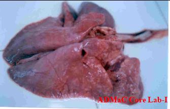 Lung consolidation